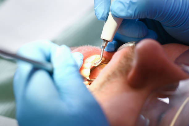 Best Broken Tooth Emergency  in Mason, OH